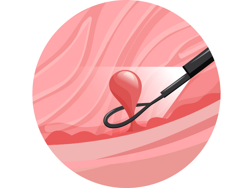 大腸内視鏡