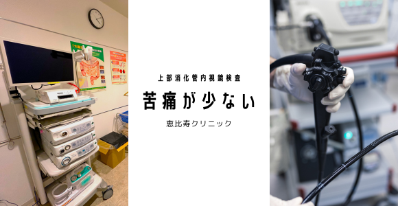 胃カメラ検査のイメージ