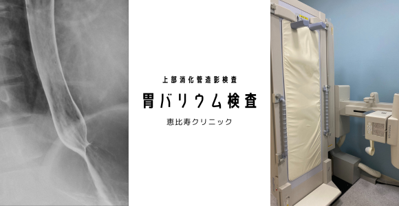 胃バリウム検査のイメージ